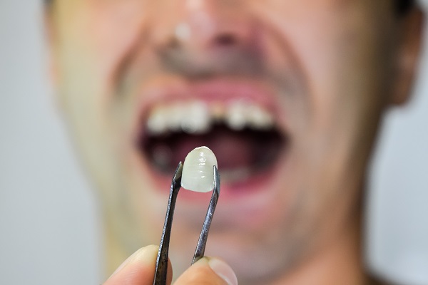Four Fixes Your General Dentist Will Recommend For A Chipped Tooth