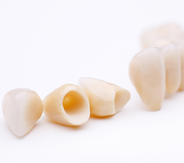 Maitland Dental Crowns and Dental Bridges