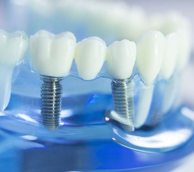Maitland Dental Implants