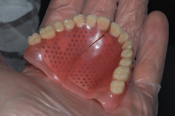 Reasons To Seek A Dentist For Denture Repair