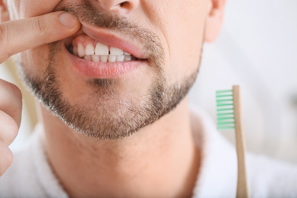 General Dentistry: What To Expect During A Teeth Cleaning