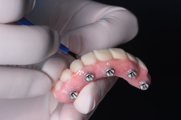 Am I A Candidate For Implant Supported Dentures?