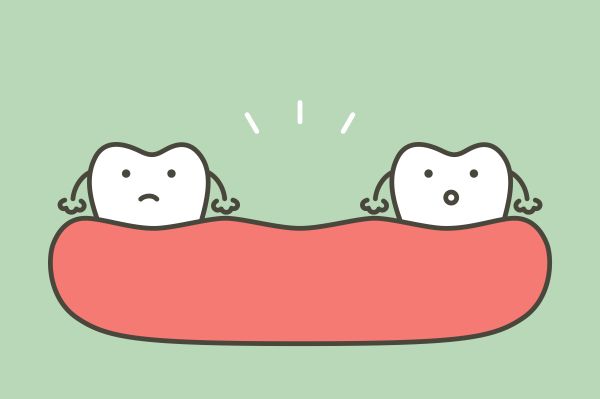 What To Do About A Missing Tooth