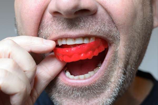 Save Your Teeth by Wearing Mouth Guards at Night from Maitland Square Dentistry in Maitland, FL